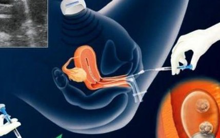 2026哈尔滨试管婴儿医院排名，附试管费用与成功率参考！